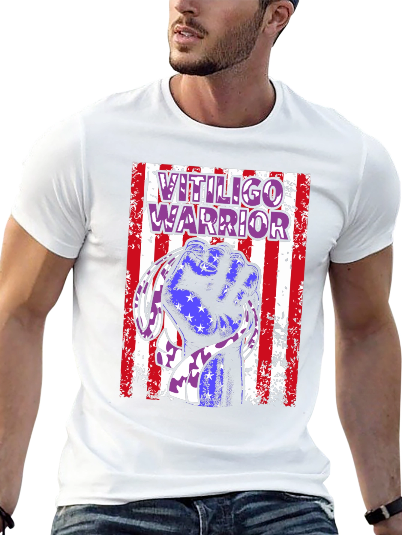Vitiligo Warrior T-Shirt - Show Your Support!